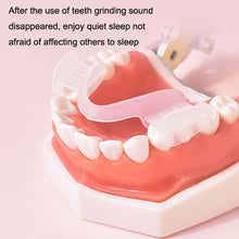 Load image into Gallery viewer, Y-Kelin Orthodontic Appliance Silicone Simulation Braces Anti-Molar Braces For Night, Transparent