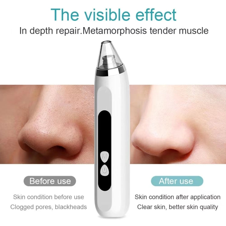 Blackhead Remover Vacuum Pore Cleaner Facial Deep Cleaning Beauty Tools, Dry Battery (Pink), Dry Battery(White)