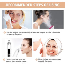 Load image into Gallery viewer, Blackhead Remover Vacuum Pore Cleaner Facial Deep Cleaning Beauty Tools, Dry Battery (Pink), Dry Battery(White)