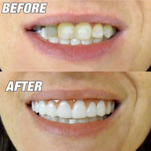 Load image into Gallery viewer, Beauty Tool False Teeth Instant Smile Comfort Fit Flex Fake Tooth Cover