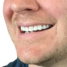 Load image into Gallery viewer, Beauty Tool False Teeth Instant Smile Comfort Fit Flex Fake Tooth Cover