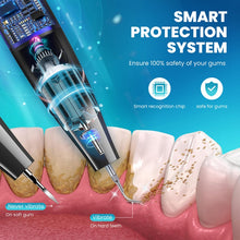 Load image into Gallery viewer, Ultrasonic Calculus Removal Dental Scaler Home Dental Cleaning Instrument