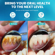 Load image into Gallery viewer, Ultrasonic Calculus Removal Dental Scaler Home Dental Cleaning Instrument