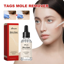 Load image into Gallery viewer, Ximonth 20ml/Bottle Anti Mole And Wart Liquid Dark Spot Tag Remover Skin Essence