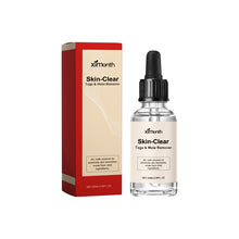 Load image into Gallery viewer, Ximonth 20ml/Bottle Anti Mole And Wart Liquid Dark Spot Tag Remover Skin Essence