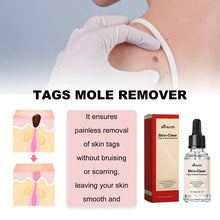 Load image into Gallery viewer, Ximonth 20ml/Bottle Anti Mole And Wart Liquid Dark Spot Tag Remover Skin Essence