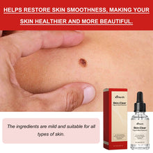 Load image into Gallery viewer, Ximonth 20ml/Bottle Anti Mole And Wart Liquid Dark Spot Tag Remover Skin Essence