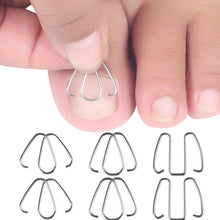 Load image into Gallery viewer, 6pcs /Box Ortho Wire Nail Insertion Orthotic Toe Nail Ortho Hooks