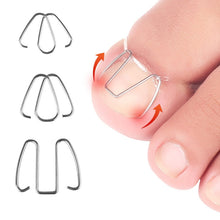 Load image into Gallery viewer, 6pcs /Box Ortho Wire Nail Insertion Orthotic Toe Nail Ortho Hooks