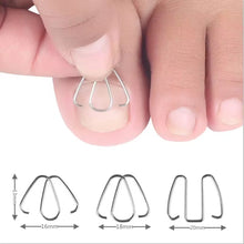 Load image into Gallery viewer, 6pcs /Box Ortho Wire Nail Insertion Orthotic Toe Nail Ortho Hooks