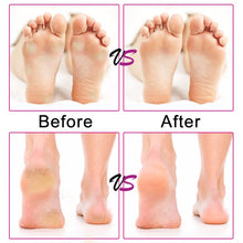 Load image into Gallery viewer, Electric Foot File Speed Adjustable Sandpaper Discs Callus Remover Pedicure Fast Remove Feet Hard Cracked Dry Dead Skin Tool, US plug, EU plug, UK plug