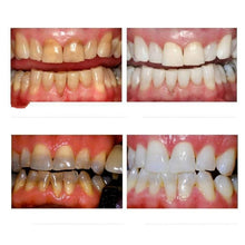 Load image into Gallery viewer, Professional Nano Teeth Whitening Oral Cleansing Set