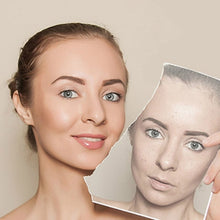 Load image into Gallery viewer, 2 PCS Professional Ultrasonic Ladies Skin Care Whitening Freckle Anti-aging Beauty Facial Machine